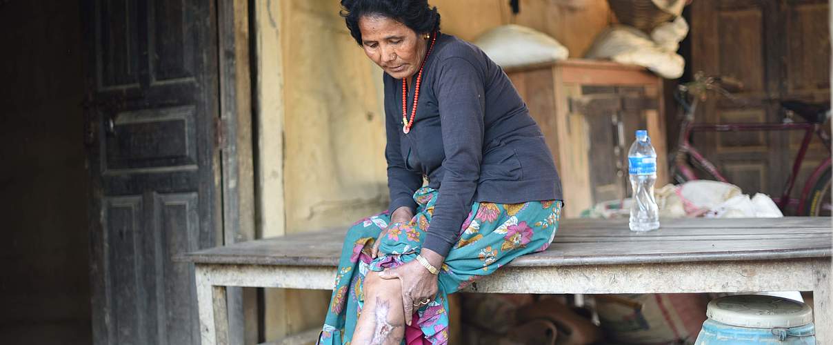 Frau mit Wunde von Leopard-Angriff © WWF Nepal