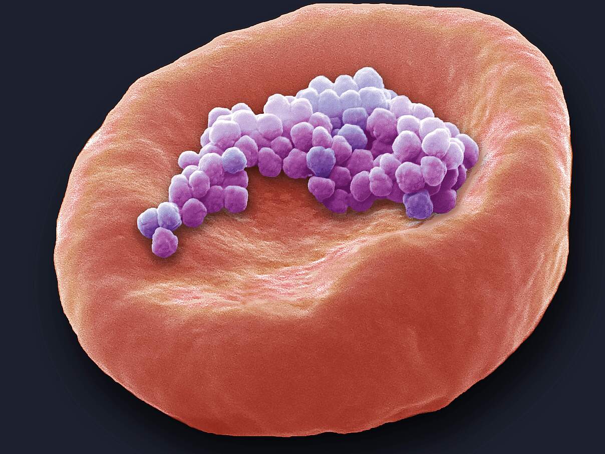 Mikroplastik auf einem roten Blutkörperchen (Rasterelektronenmikroskopscan)