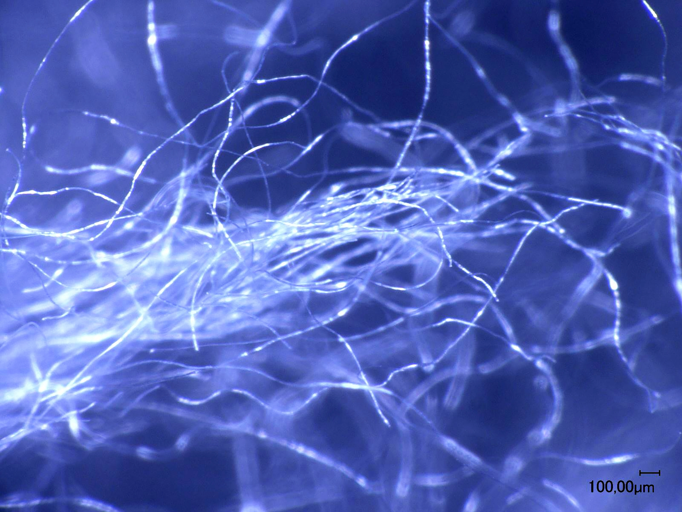 Mikrofleecefasern aus synthetischer Fleecekleidung © Fraunhofer UMSICHT Mikrofleecefasern aus synthetischer Fleecekleidung © Fraunhofer UMSICHT